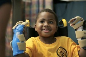 Zion-Harvey Zion Harvey of Baltimore, Maryland posing with his newly transplanted hands shortly after his transplant in 2015 File picture CHOP AFP