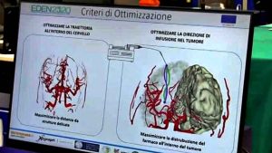 La robotica medicale in campo contro i tumori al cervello