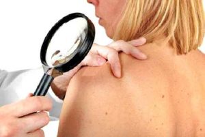 Melanoma, la proteina