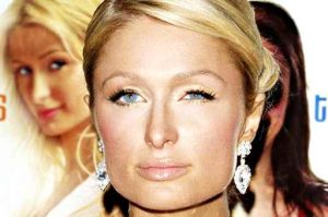 Paris Hilton e il suo occhio pigro