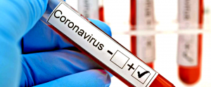 1CORONAVIRUS