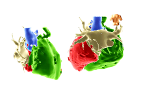 Mappaggio_cardiac