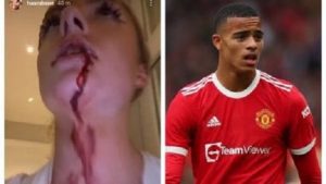 Calcio/ La fidanzata accusa Greenwood: "Mi picchiava a sangue"